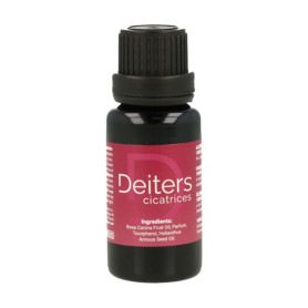 Deiters Scars Deiters